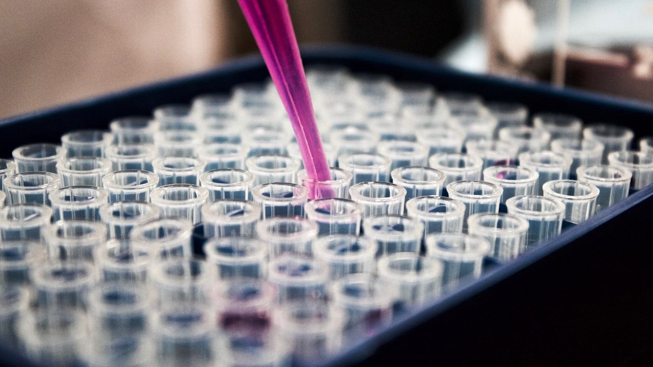Pipette dispensing pink liquid into a laboratory microplate — chemistry lab experiment
