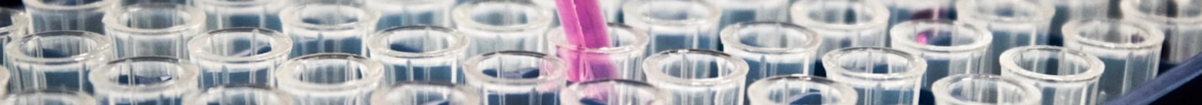 Pipette dispensing pink liquid into a laboratory microplate — chemistry lab experiment