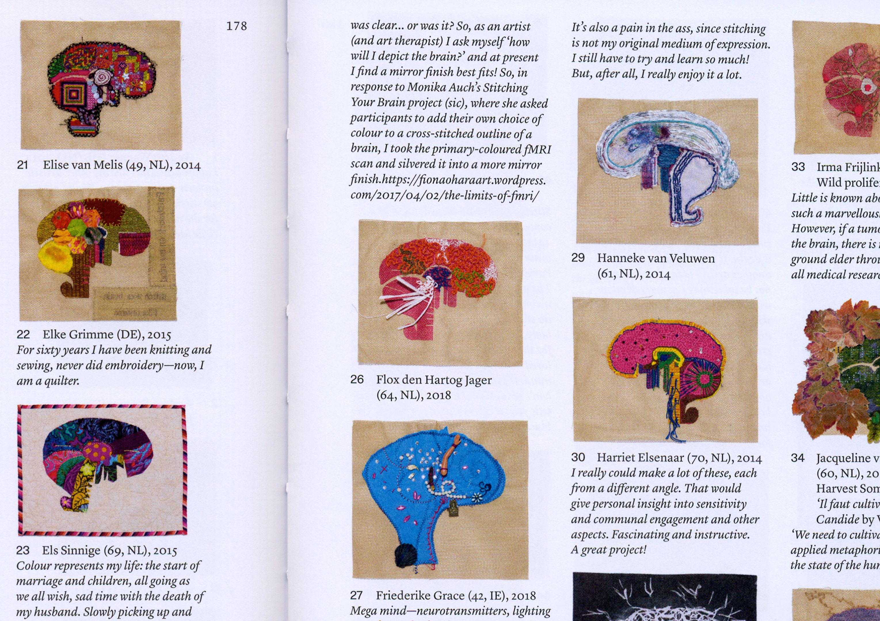 Stitch Your Brain_7_ZOOM