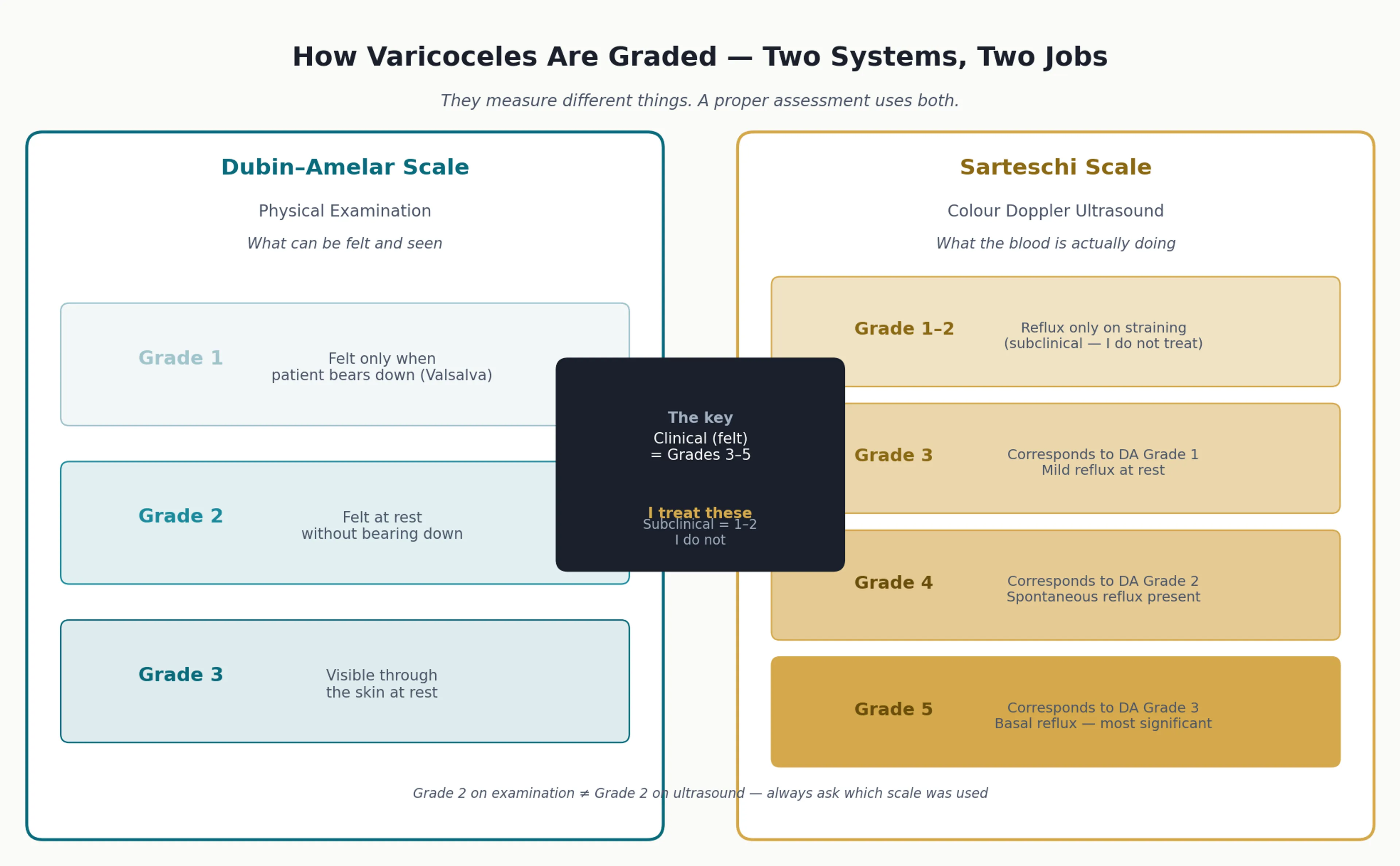 Grading scales comparison: Dubin-Amelar physical examination grades 1-3 vs Sarteschi Doppler ultrasound grades 1-5
