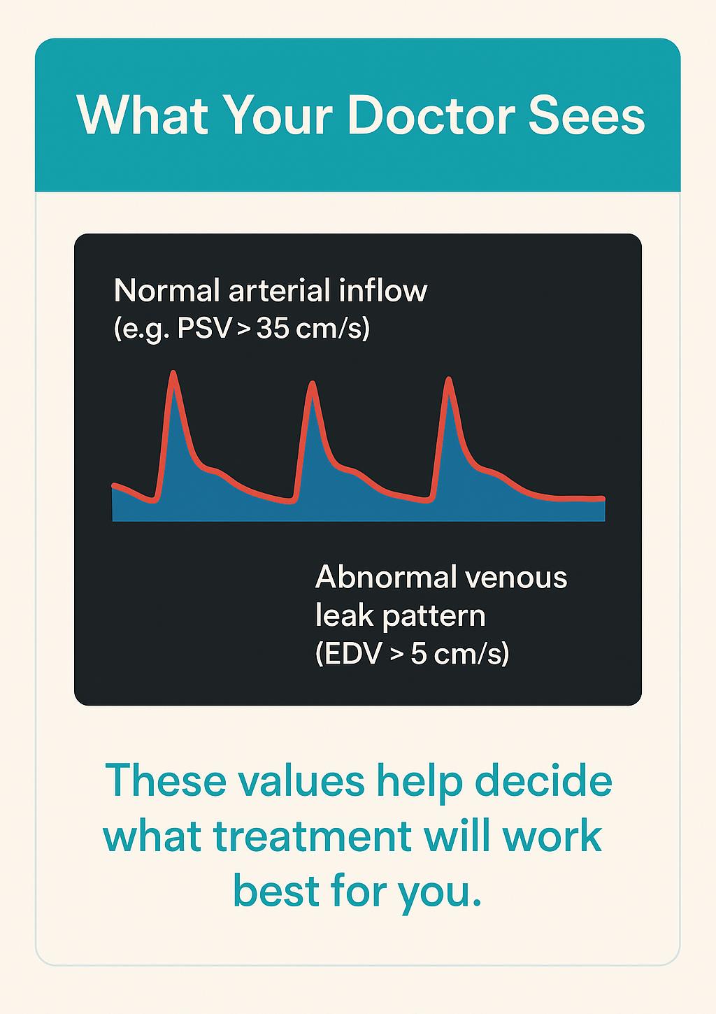 alt="Stylised Doppler waveform showing normal arterial inflow and abnormal venous leak pattern."