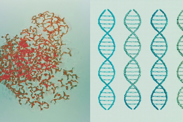  ZyMōt sperm selection — should I use it?