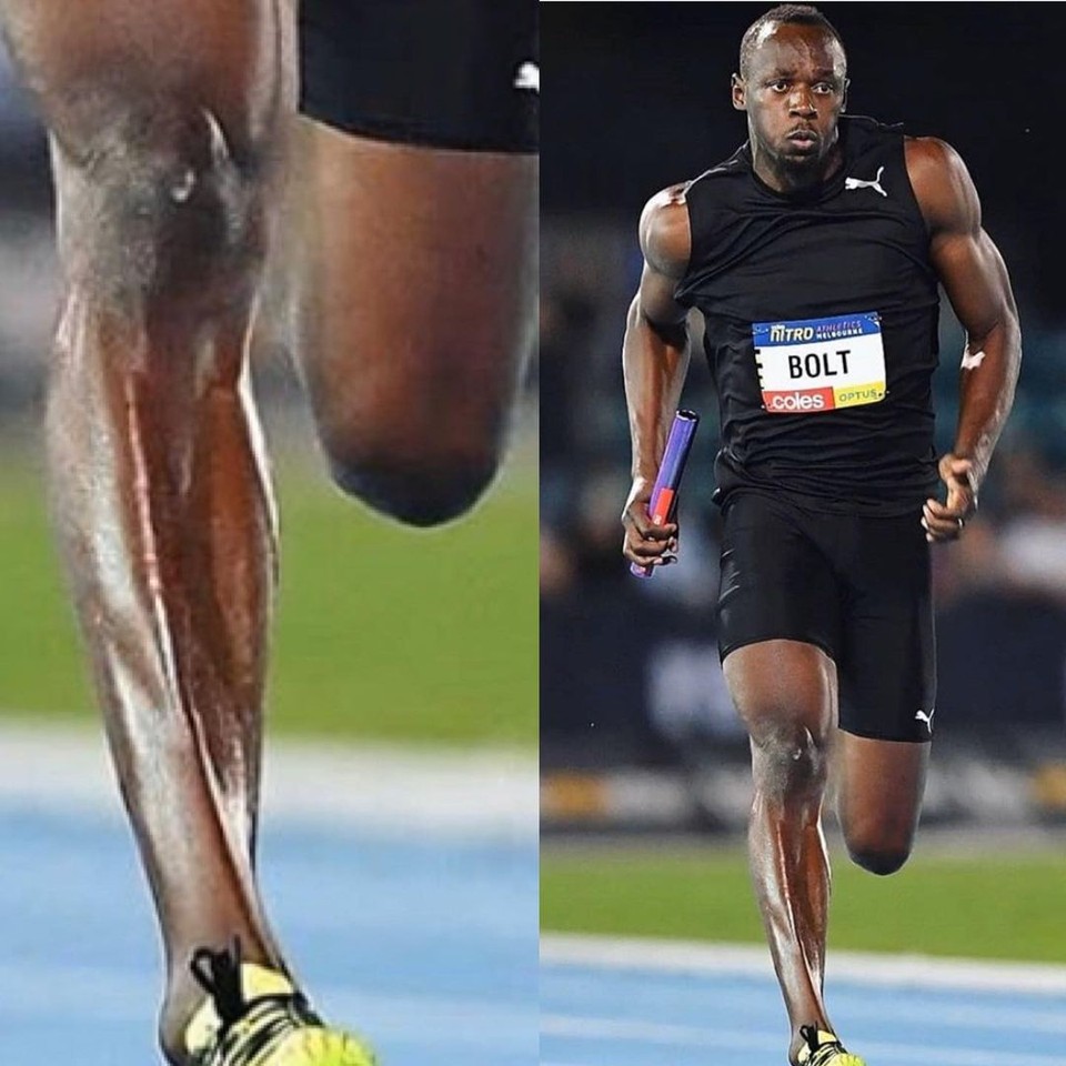 Comparison showing a close-up of Usain Bolt's prominent Achilles tendon and lower leg alongside Bolt sprinting on the track, illustrating the elastic lower-limb structure characteristic of world-class speed and power.