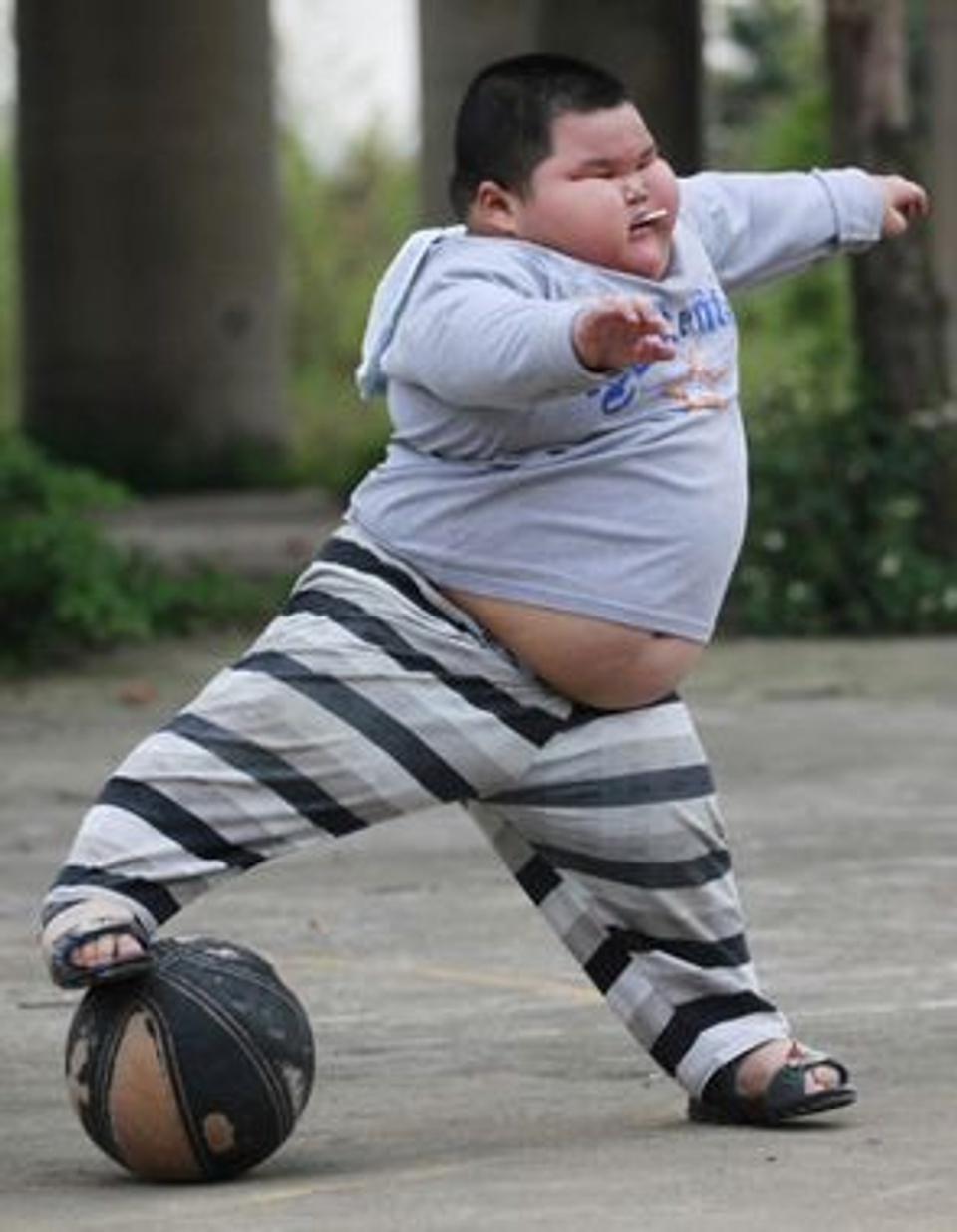 Child with obesity playing basketball outdoors, representing the increasing rates of childhood obesity and declining physical health highlighted in this article.