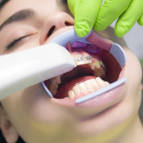 Orthodontic Treatment
