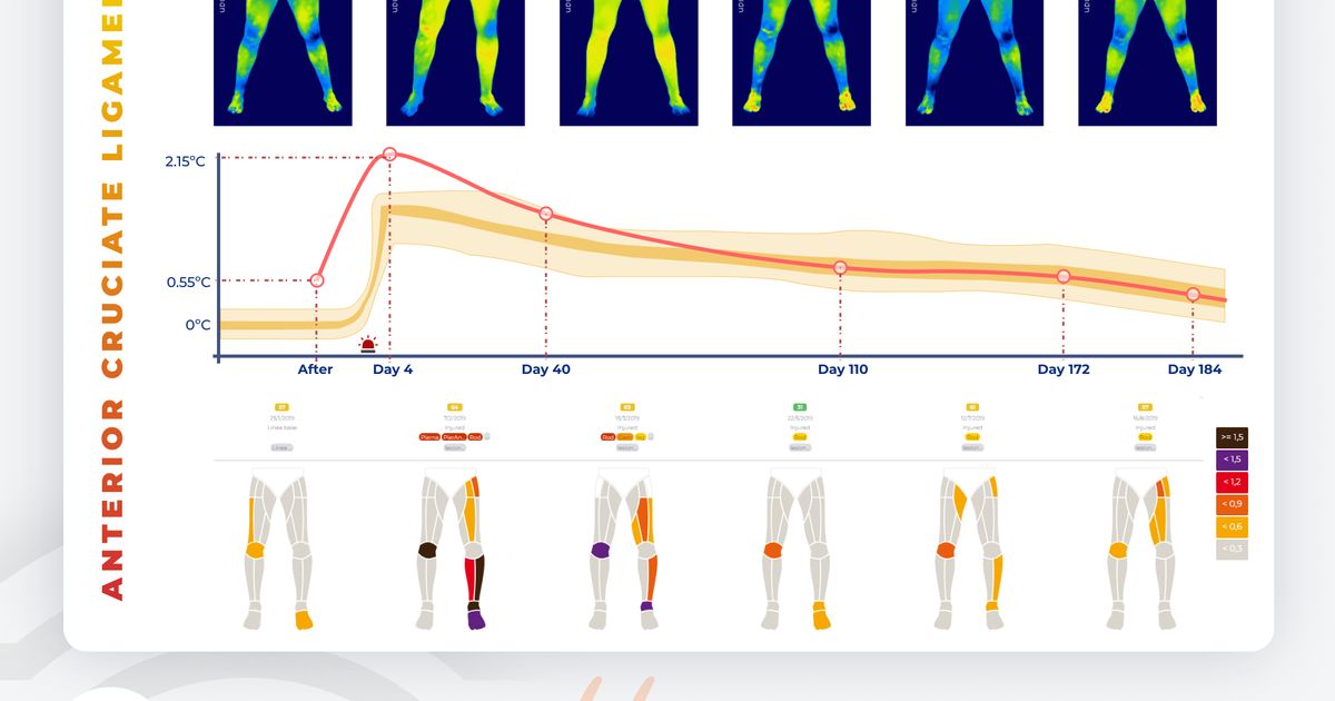 Acl Reconstruction Graph The evolution graph of an anterior cruciate ligament (ACL) injury ...