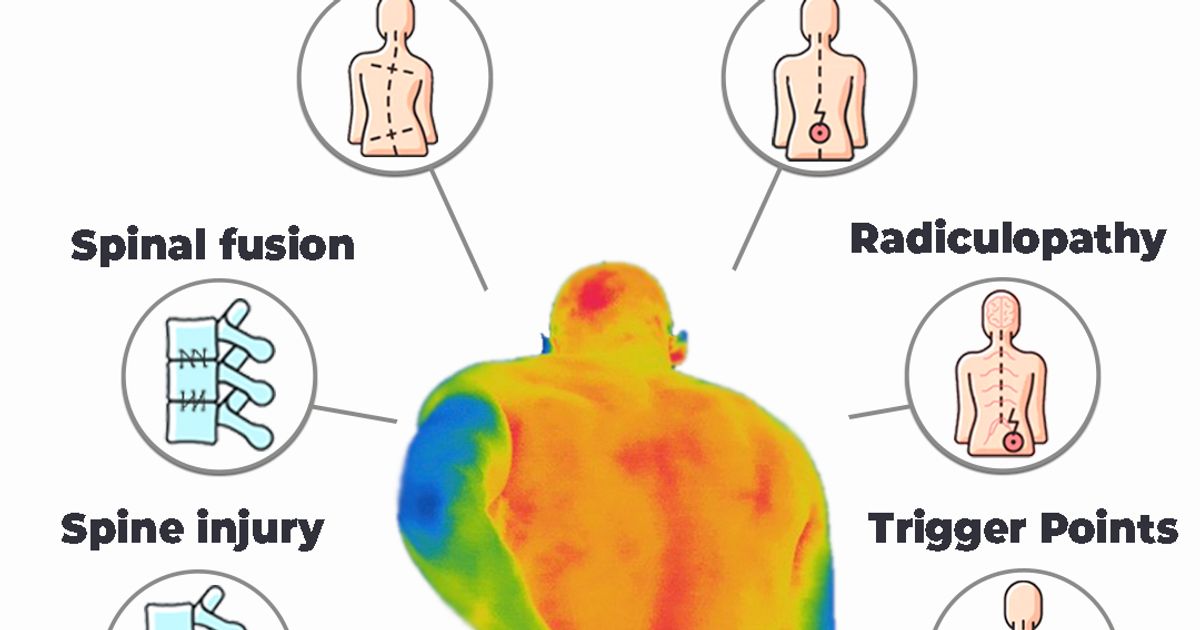 Back Pathology Thermography and back pathology | ThermoHuman