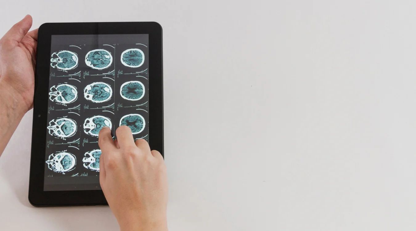 Person holding tablet displaying brain MRI scans in a grid layout with cyan and black contrast