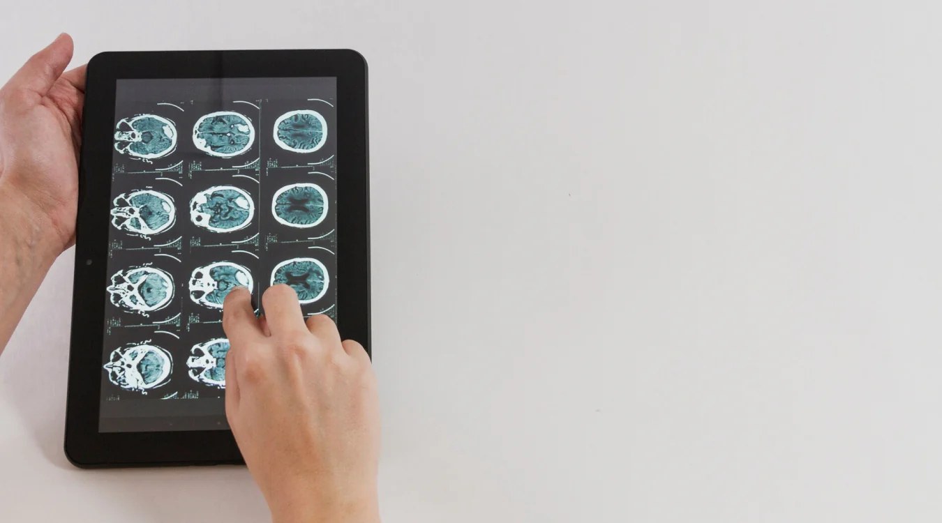 Person holding tablet displaying brain MRI scans in a grid layout with cyan and black contrast
