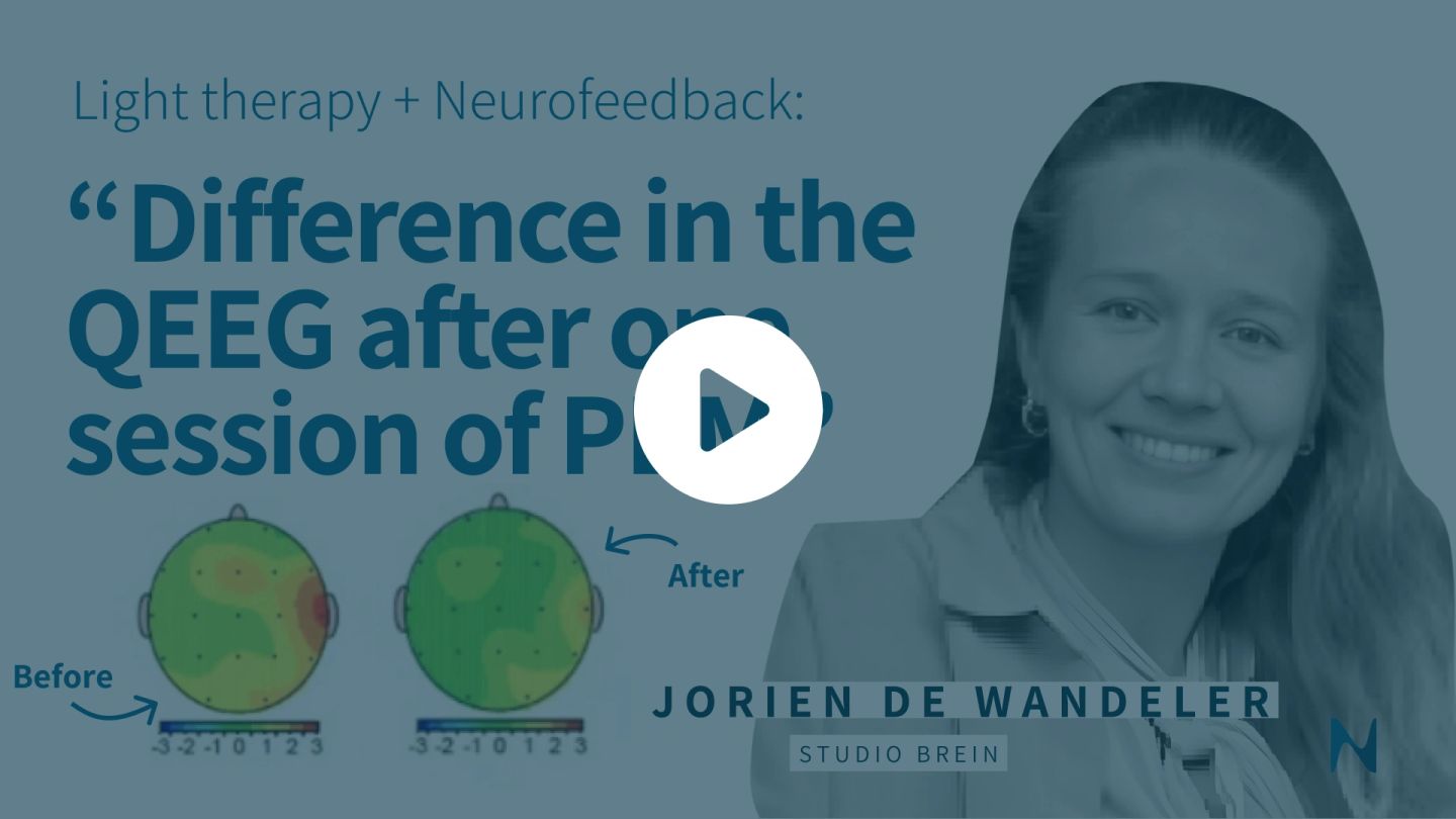 The acute effect of PBM on the EEG of a stroke patient suffering from aphasia.