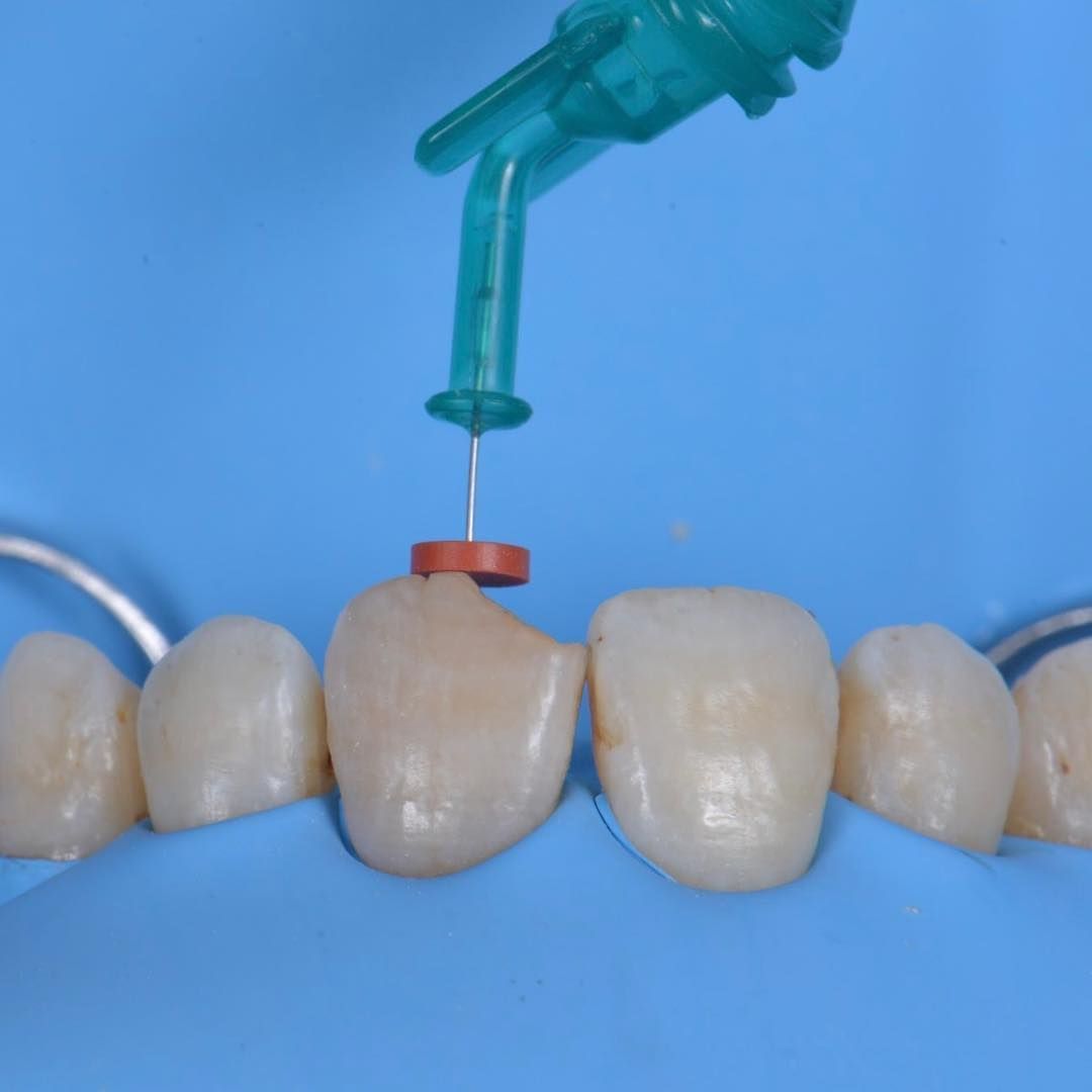 Endodoncia