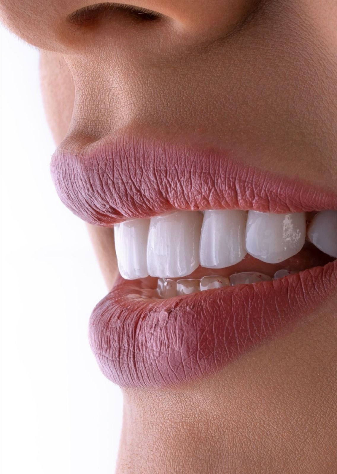 Diseño de Sonrisa