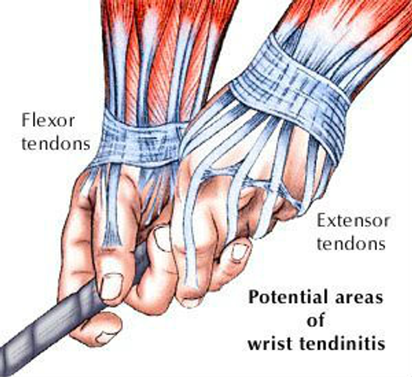Golf wrist injuries and hand physiotherapy Phoenix Rehab Singapore