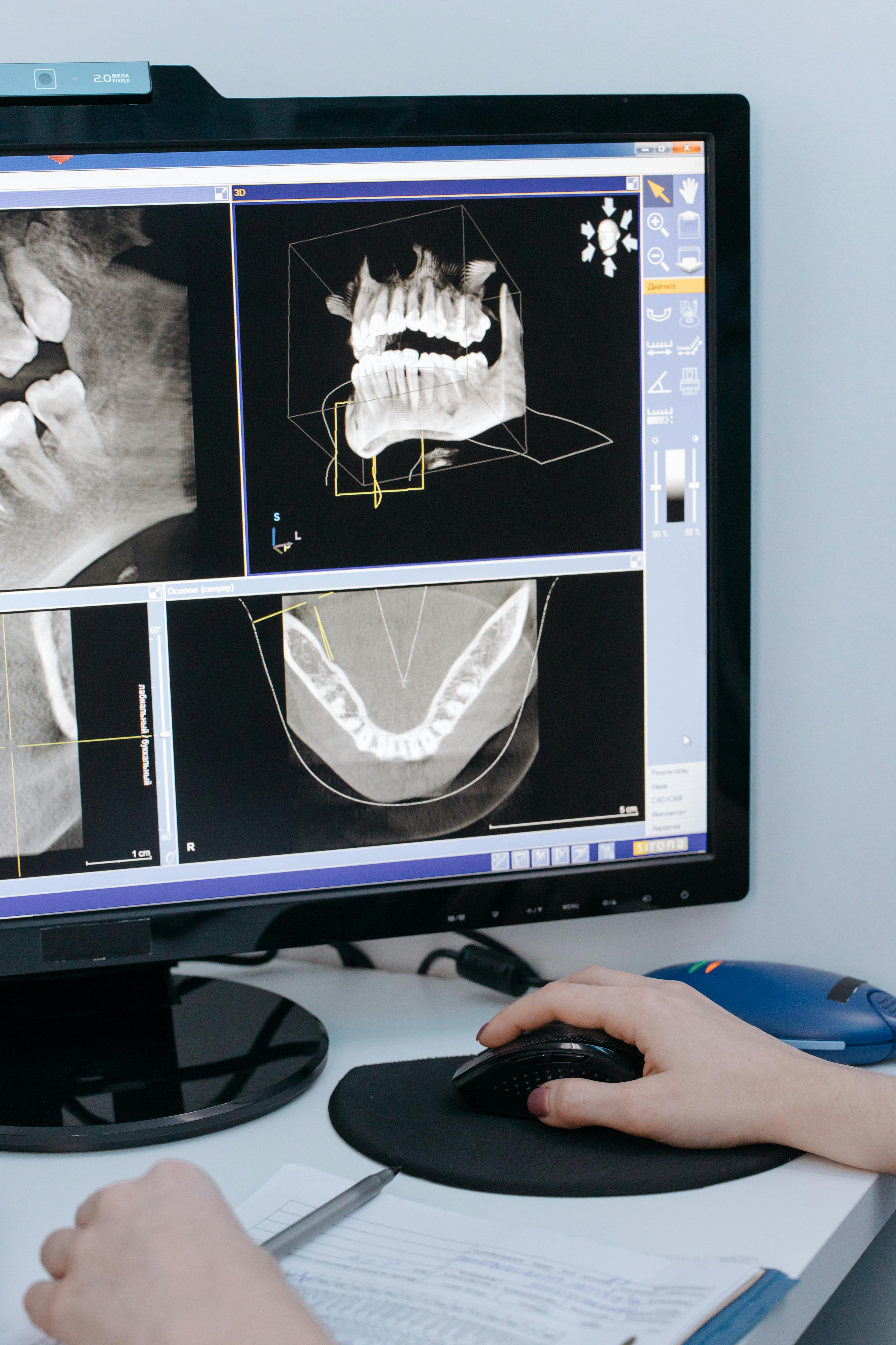 Crown Dental lab