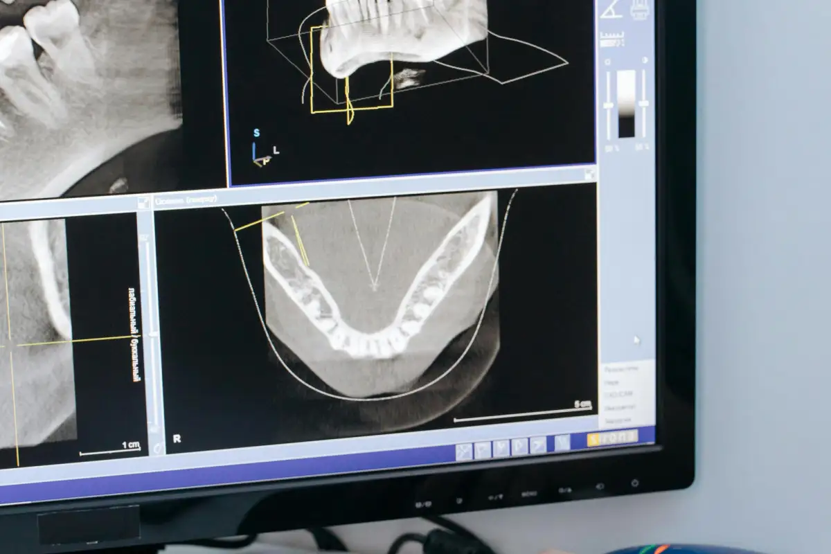 Crown Dental lab