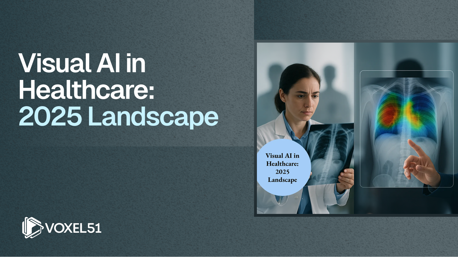 Healthcare Computer Vision Computer vision in healthcare: 12 breakthrough case studies