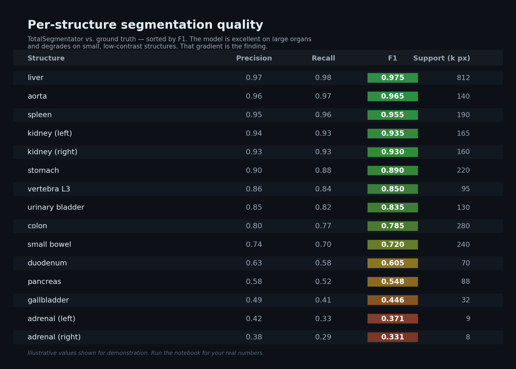 Table ranking TotalSegmentator structures by F1, liver and aorta highest, pancreas and adrenal glands lowest.