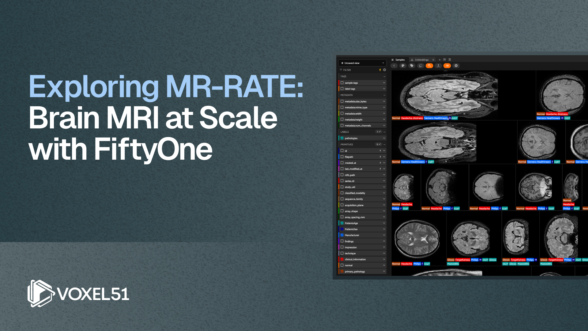 Axial brain MRI slices from the MR-RATE dataset, each paired with a radiologist report and clinical metadata