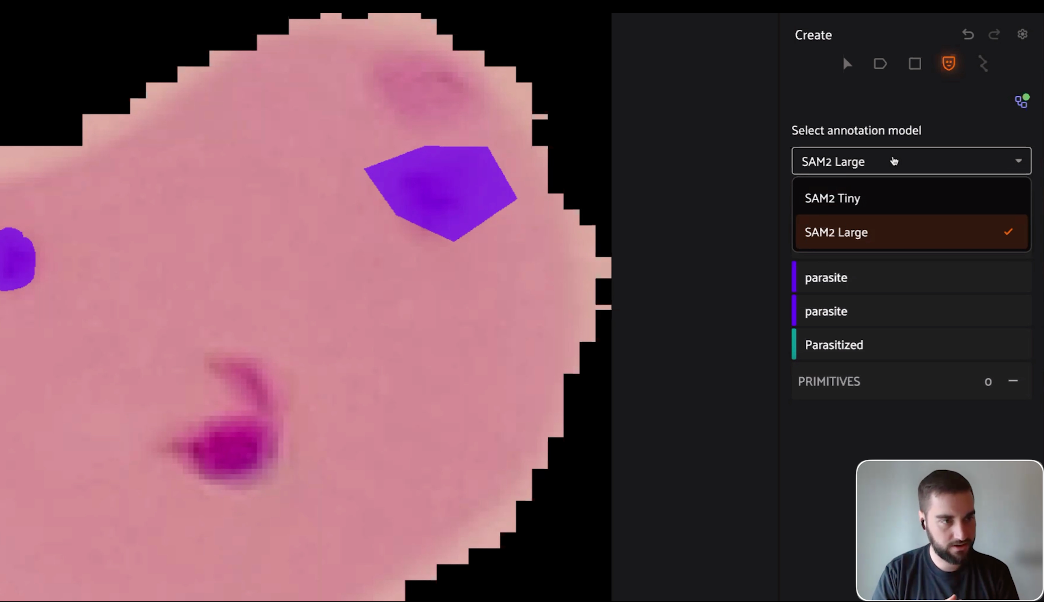 Annotation model dropdown in FiftyOne showing SAM2 Tiny and SAM2 Large, with a polygon parasite mask and parasitized classification already applied