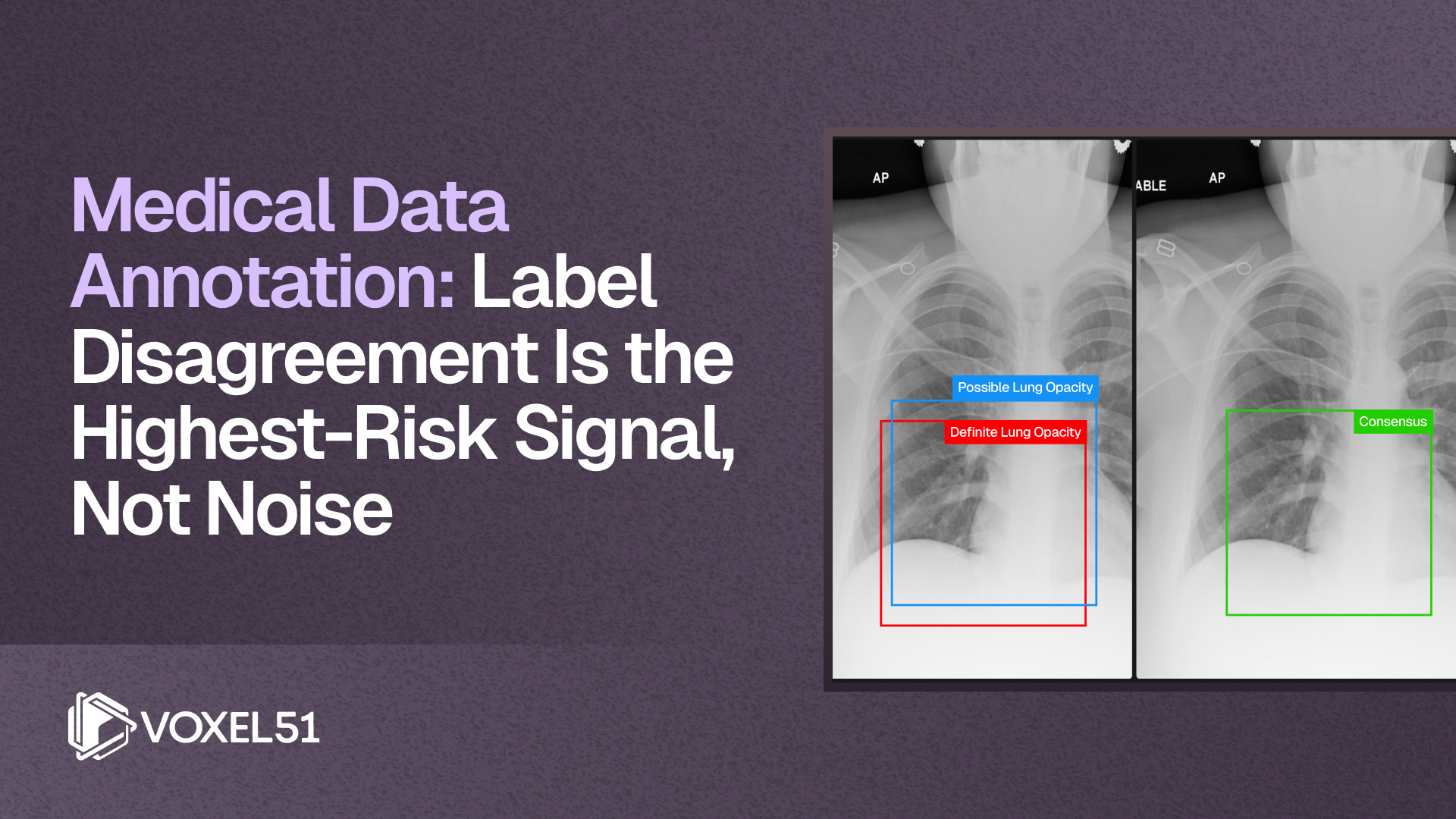 Thumbnail image with the title: Medical Data Annotation: Label Disagreement Is the High-Risk Signal, Not Noise