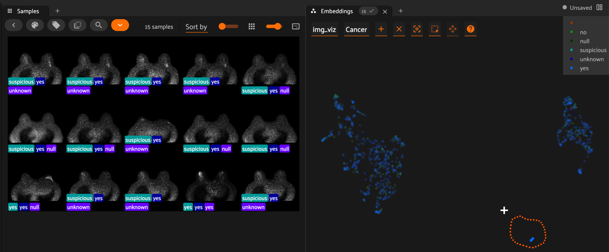 FiftyOne embedding visualization surfaces an outlier cluster of mammography samples that, on inspection, turns out to be blurry images