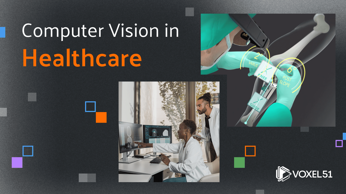 Healthcare Computer Vision Computer vision in healthcare: 12 breakthrough case studies