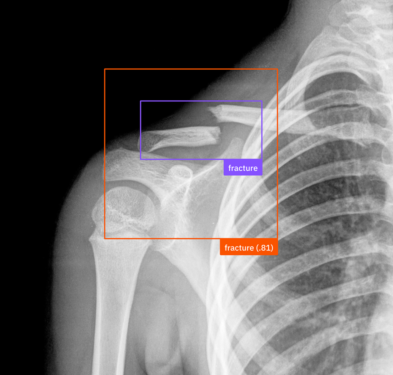 FiftyOne allows you to visualize model predictions against ground truth labels