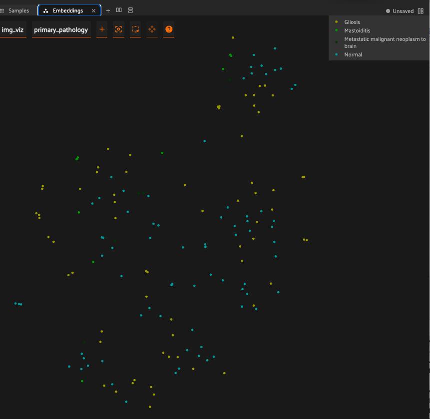 t-SNE embedding plot of MR-RATE brain MRI scans in FiftyOne, colored by pathology to show condition clusters