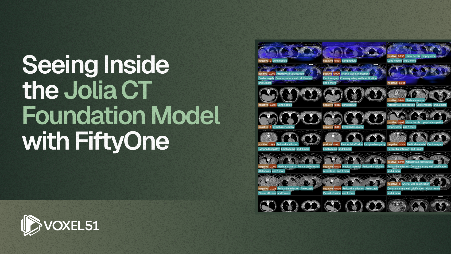 Seeing Inside the Jolia CT Foundation Model with FiftyOne Tutorials • Jul 8, 2026