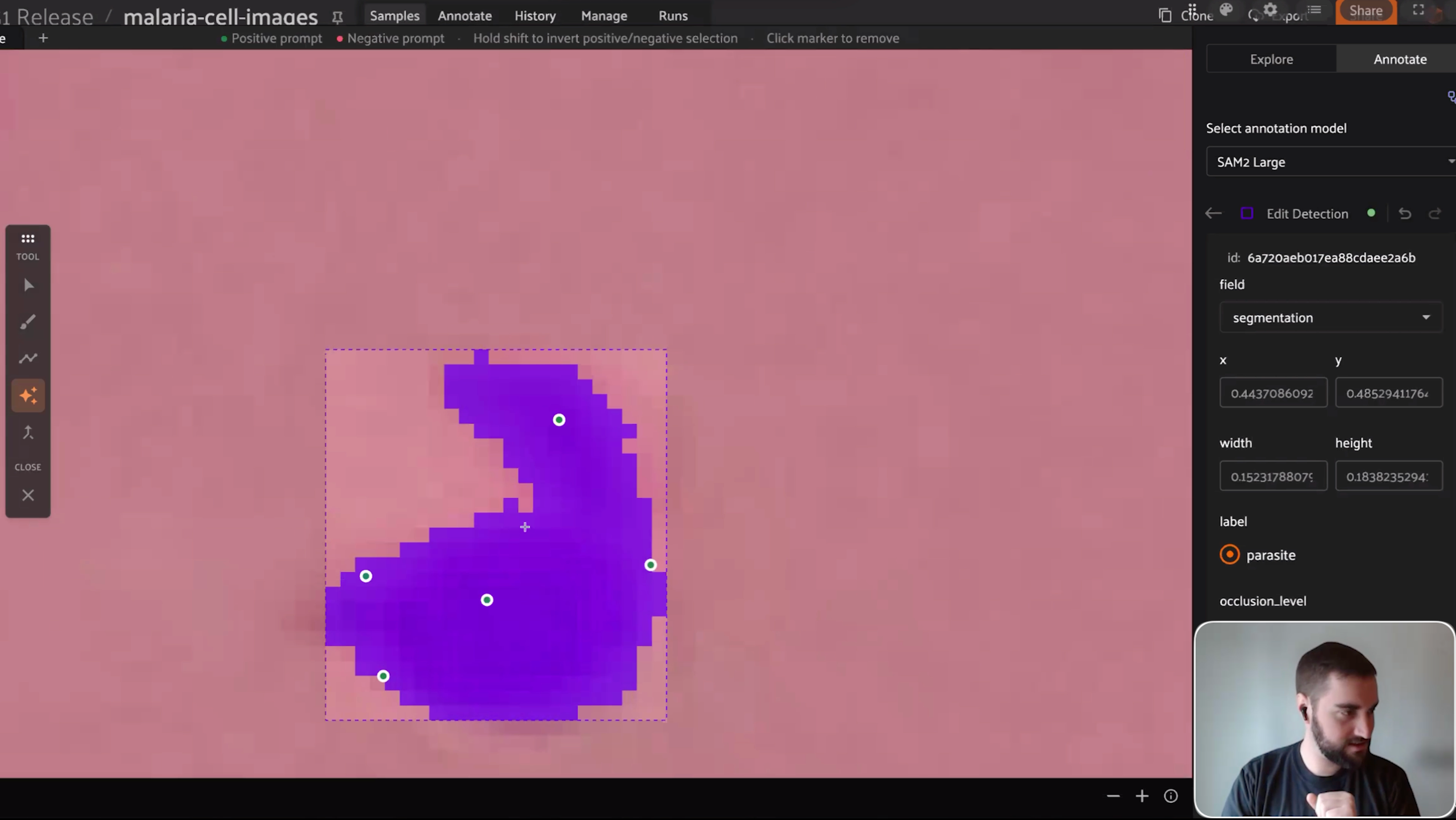 SAM 2 segmentation mask on a parasite in FiftyOne with several green positive keypoints and the detection edit panel open