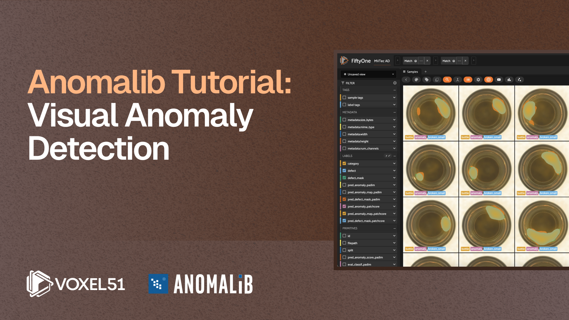 Image of visual anomaly dectaction with FiftyOne, and the blog title: Anomalib Tutorial on Visual Anomaly Detection