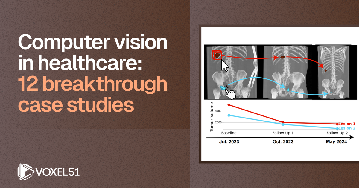 Computer Vision Medical Output Computer vision in healthcare: 12 breakthrough case studies