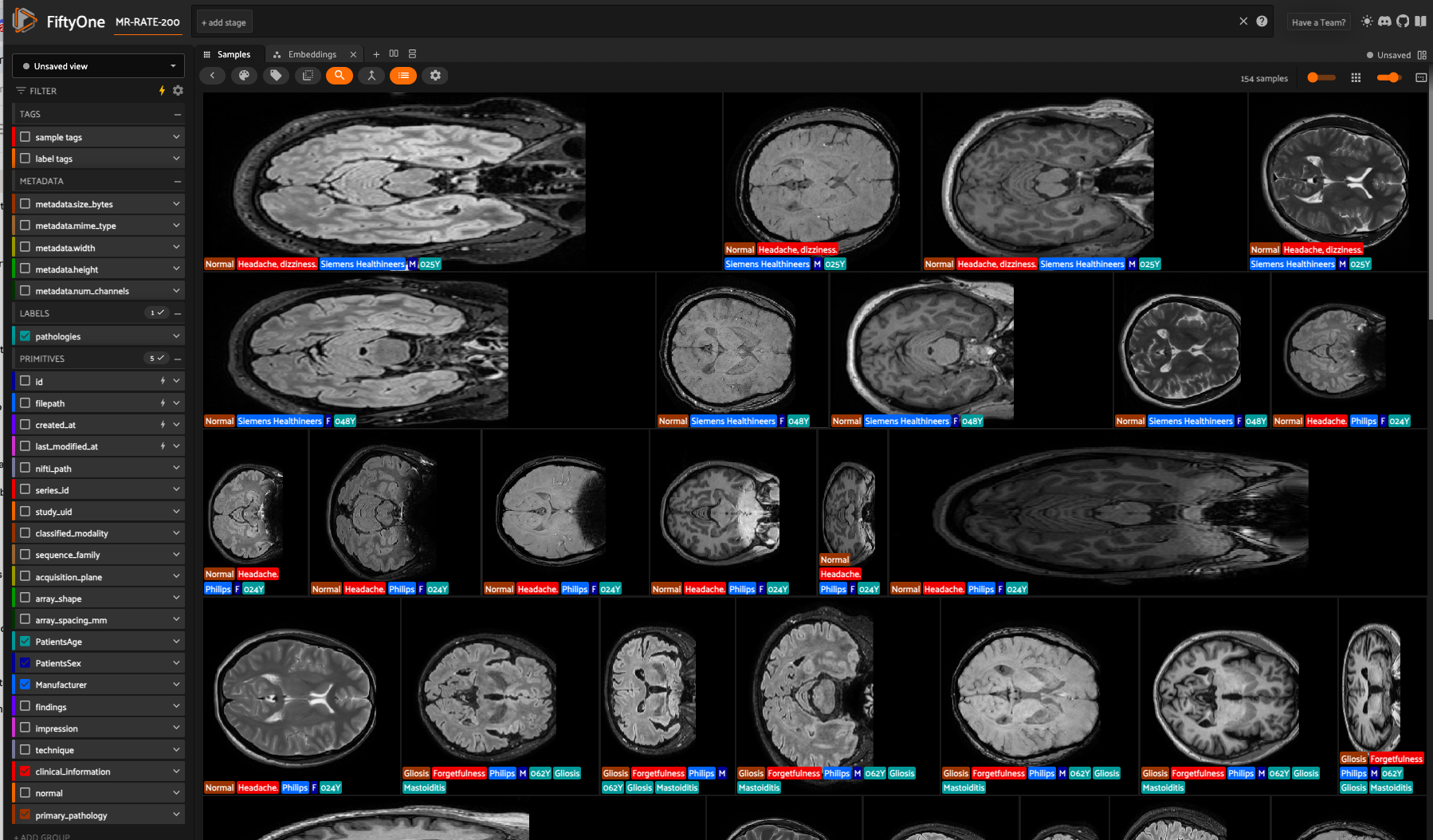 FiftyOne sidebar filtering MR-RATE brain MRI scans by pathology, MRI sequence, and scanner manufacturer