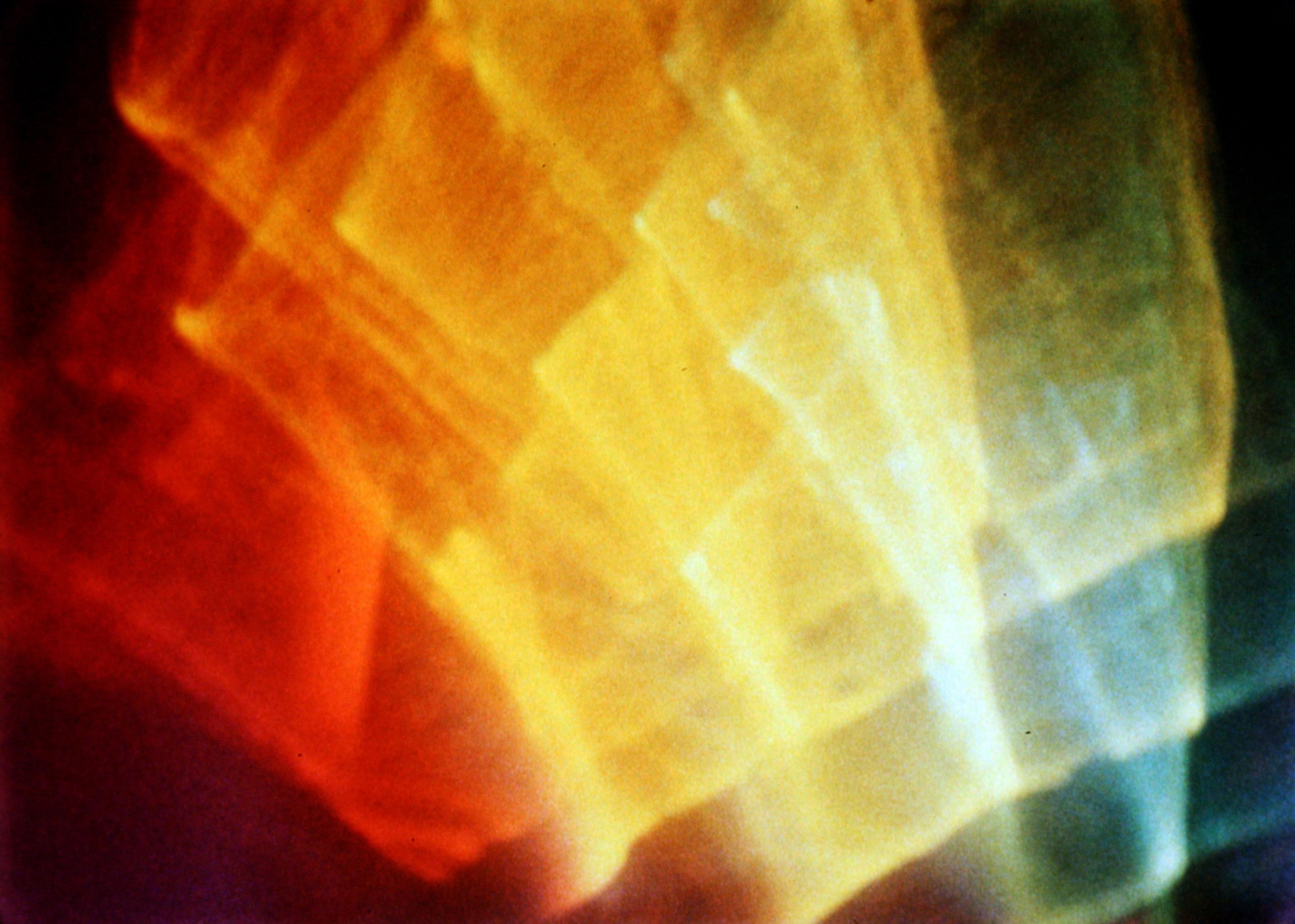 Jim Davis, film still from Let There Be Light , 1956. 35mm transferred to digital video, colour, silent, 11:50mins. All courtesy of Anthology Film Archives, New York City.
