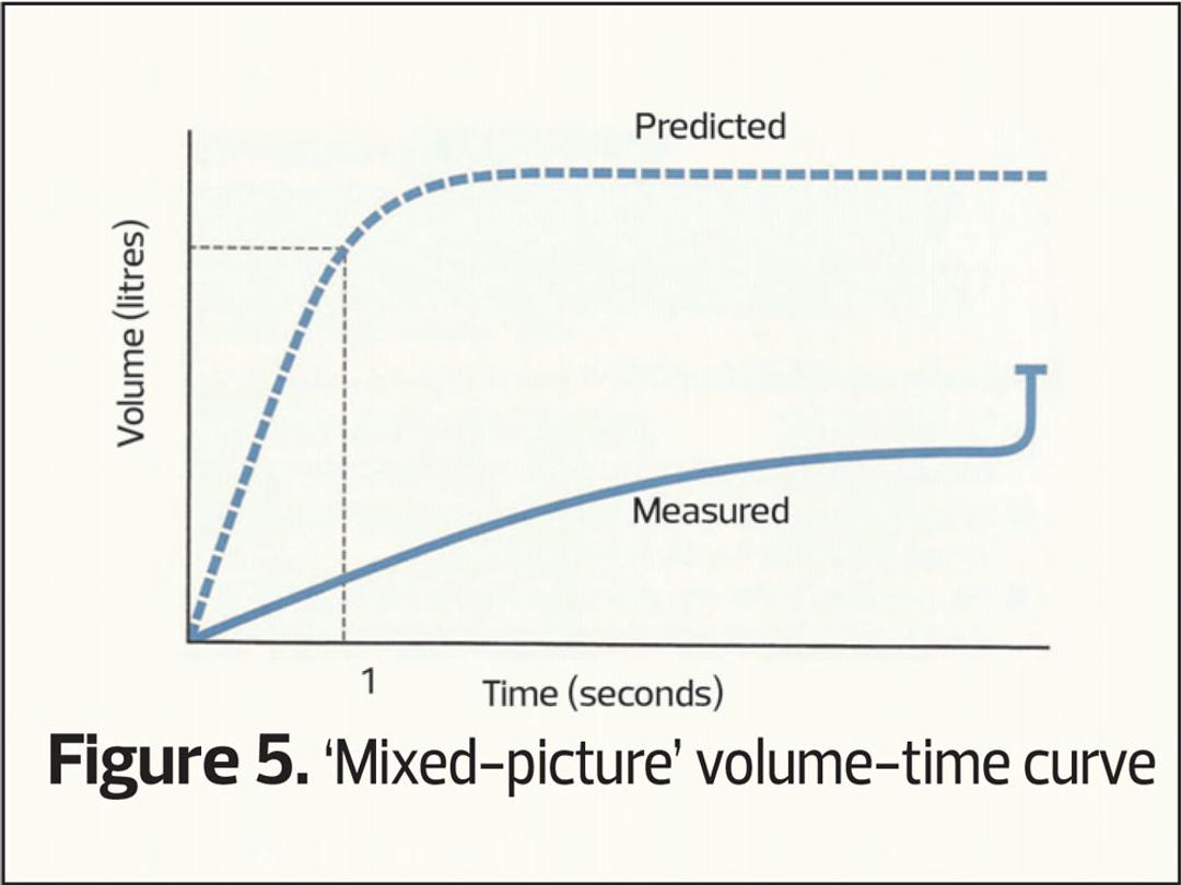 Spirometry: interpretation in the clinical situation