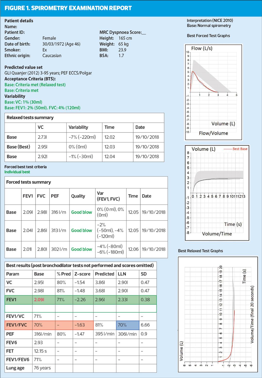 Spirometry – moving forward towards early and accurate diagnosis