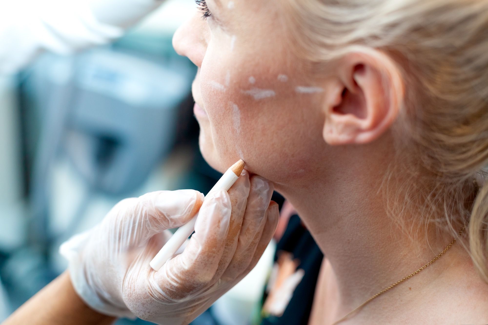 Profesjonell fotografering av behandling ved TM Klinikken