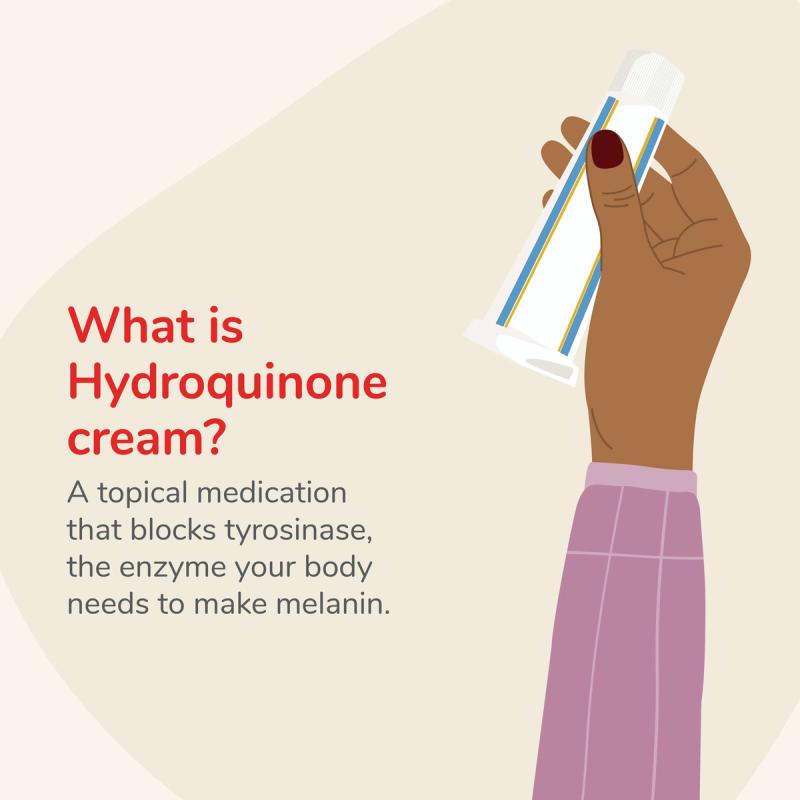 Illustration of hand hold tube of cream to the right of text explaining what hydroquinone cream is