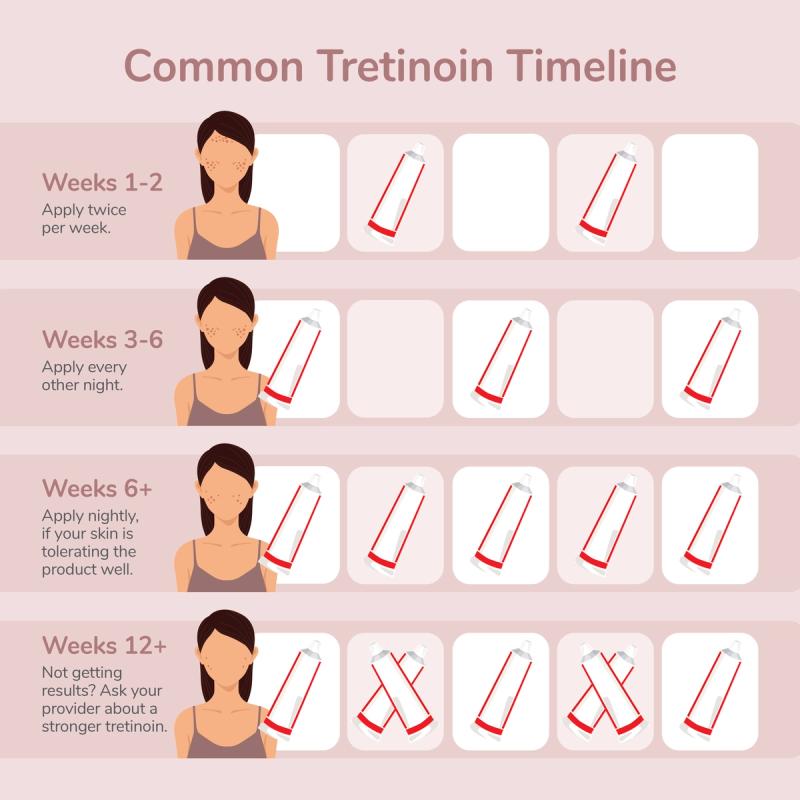 Chart showing a common tretinoin timeline.