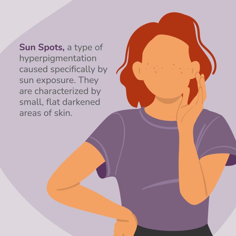 Illustration of someone with sun spots.