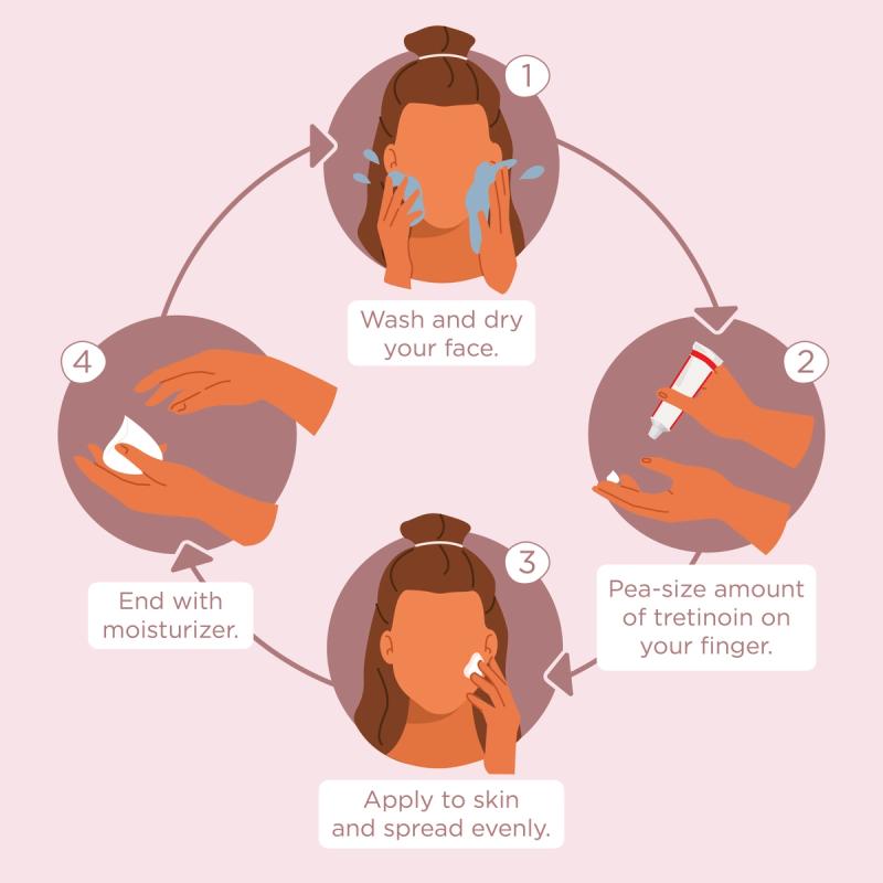 Illustration of how to apply tretinoin.