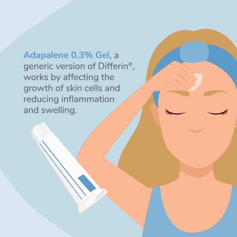 Woman Applying Adapalene Gel With Description of Adapalene 0.3% Gel