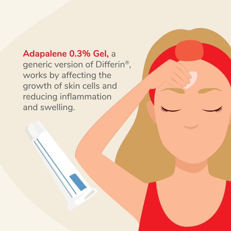 Woman Applying Adapalene Gel With Description of Adapalene 0.3% Gel
