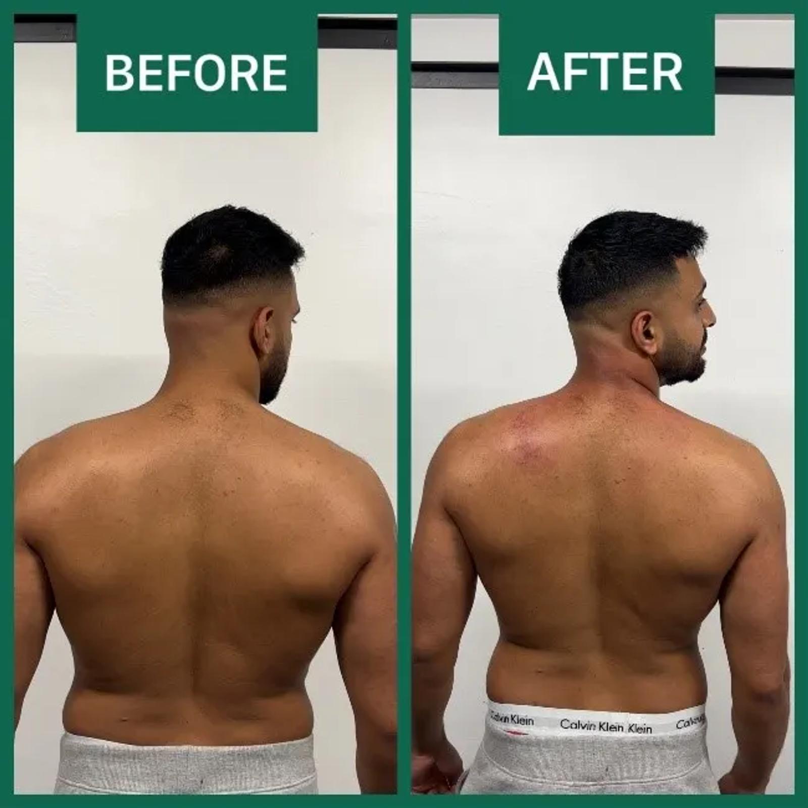 Before and after neck mobility comparison following treatment