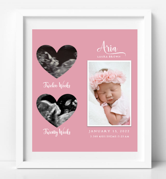 Ultrasound Frame