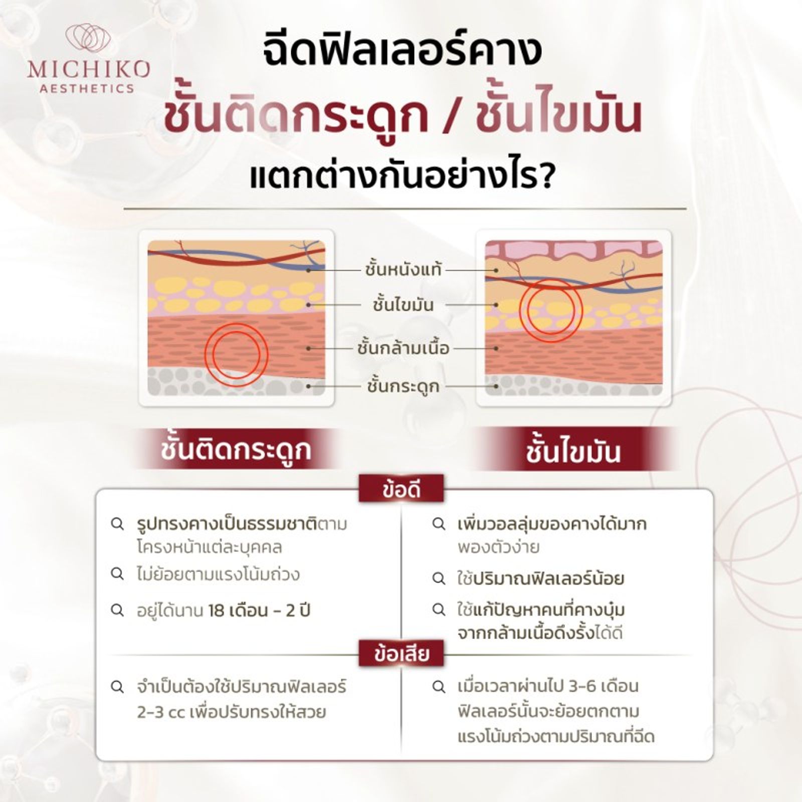 ปัญหาฉีดฟิลเลอร์แล้วคางย้าย สาเหตุเกิดจากอะไร? — ภาพประกอบ 01