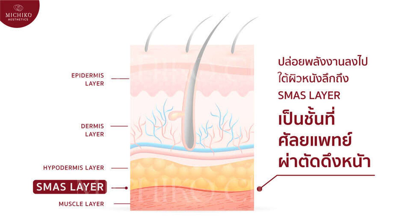 ชั้นผิวหนังใบหน้า