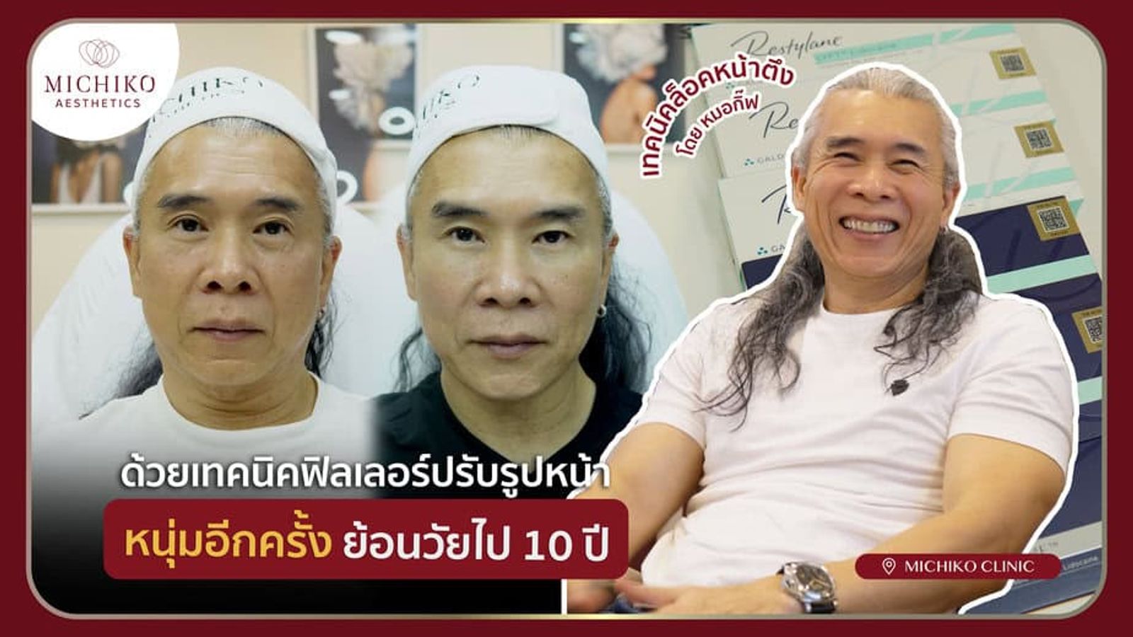[รีวิว] ปฏิบัติการ Make Over ด้วยฟิลเลอร์ลดอายุลงไป 10 ปี กับเทคนิคของอาจารย์หมอกิ๊ฟ