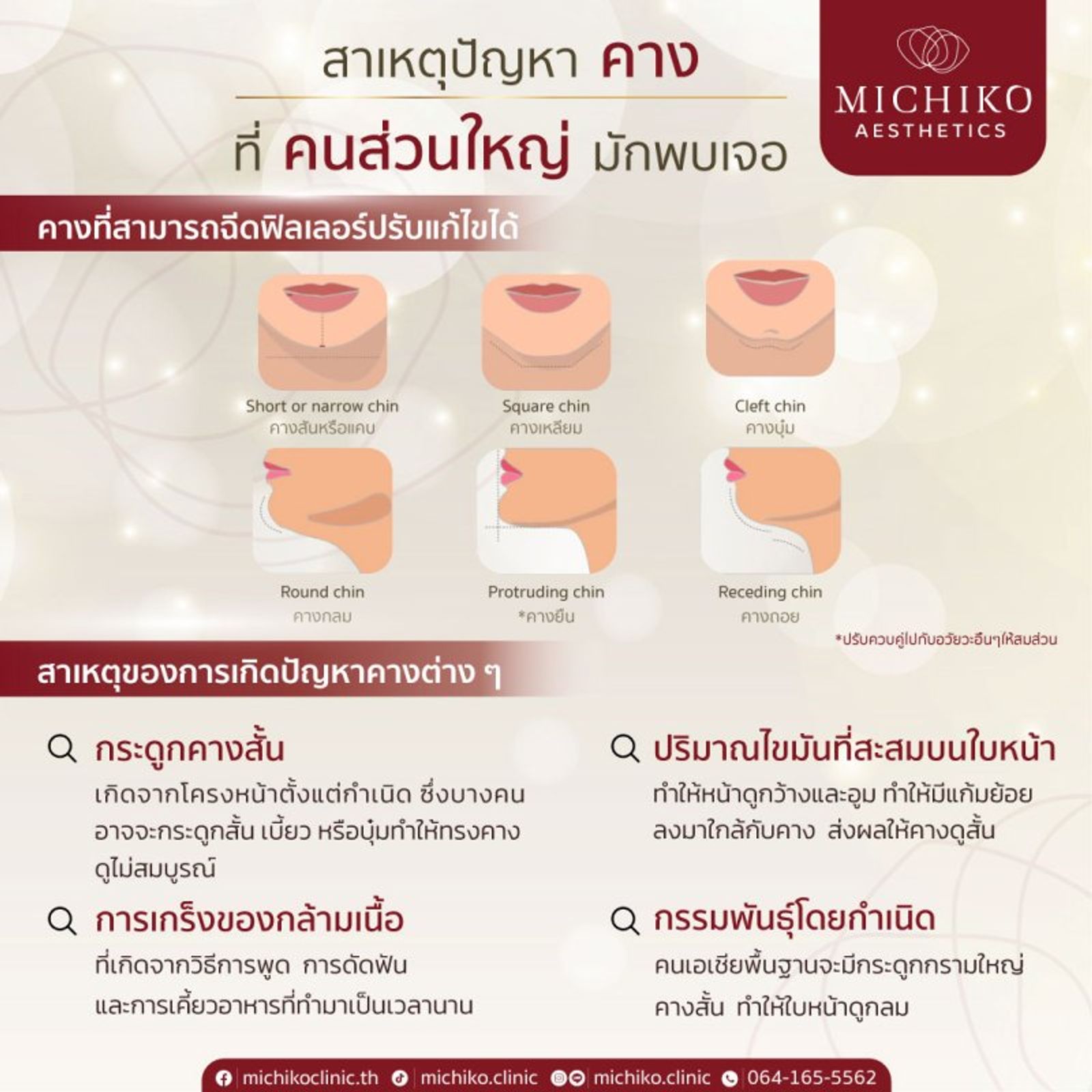 ปัญหาคาง