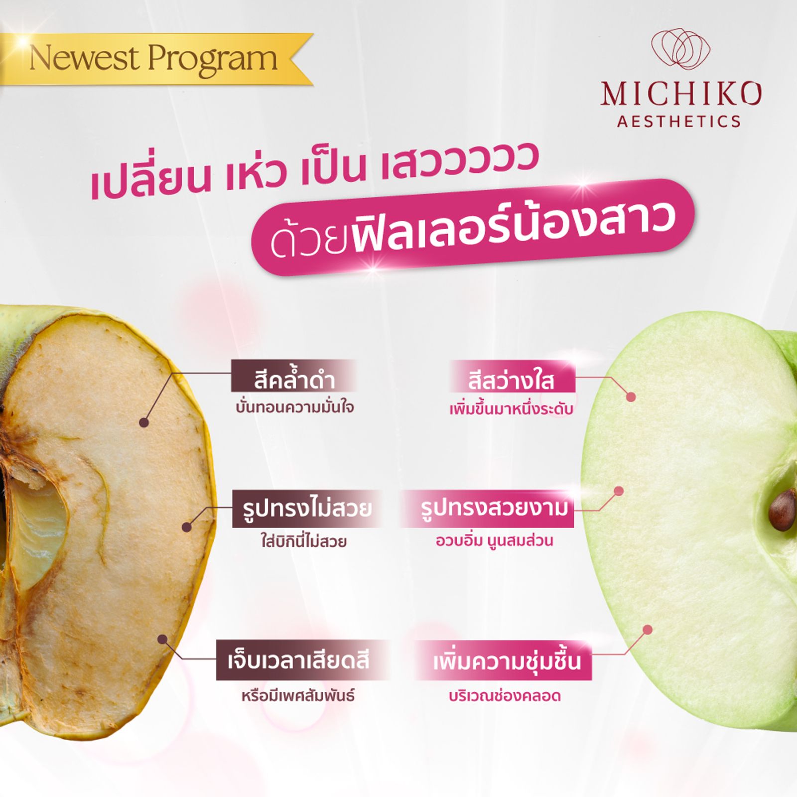 ฟิลเลอร์น้องสาว